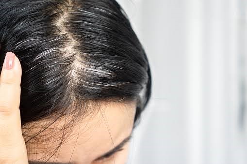 Ultimate Guide to Hair Loss Treatment In 2022: Everything You Need to Know