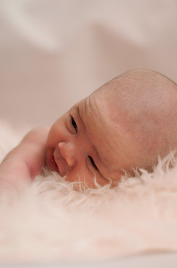 Bald Patches on the Head in Children